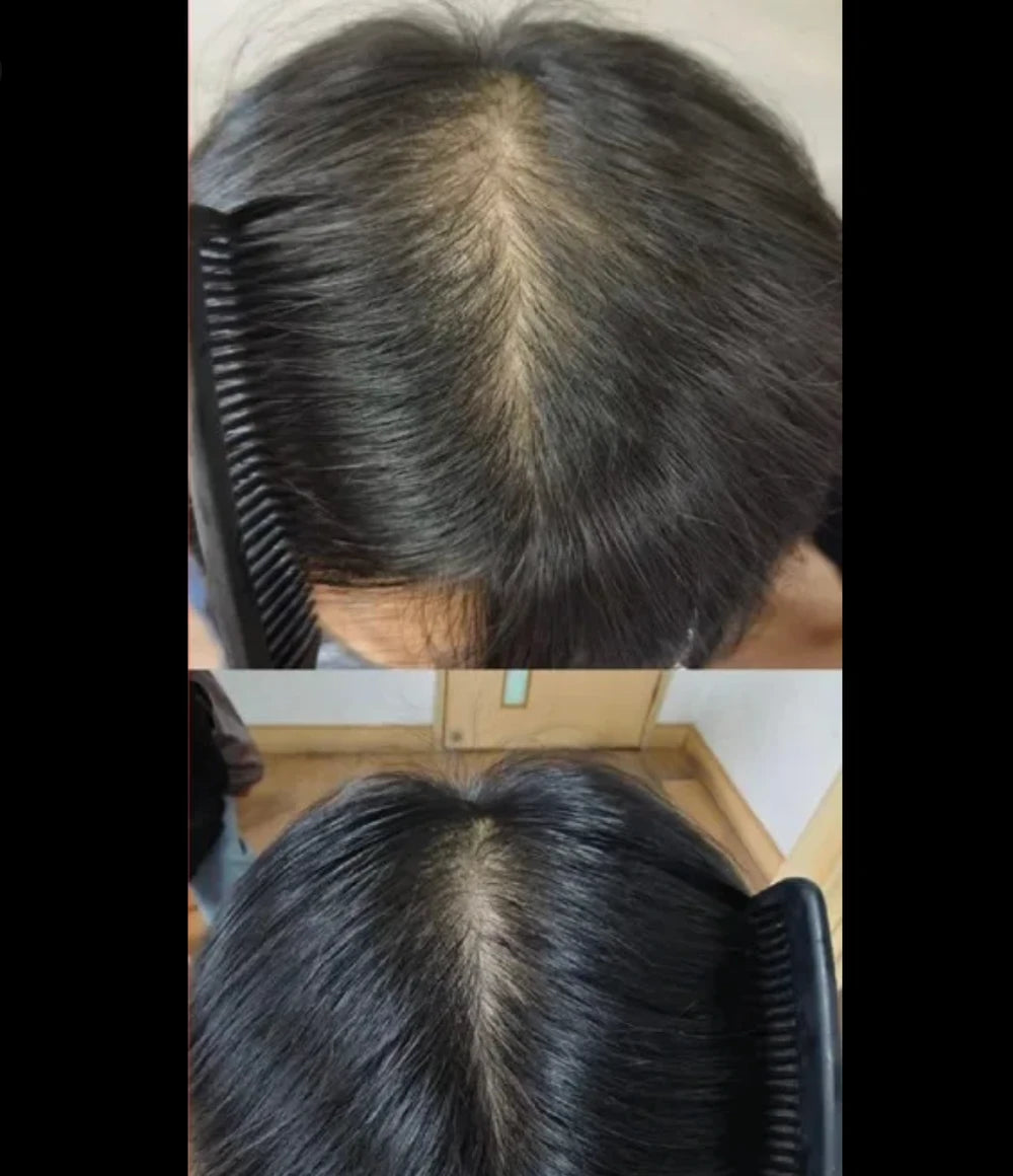 Natural Hair Growth Oil Rosemary Anti Hair Loss Regrowth Moisturizing Repair Anti Baldness Fast Hair Growth Serum Oil